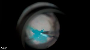 Extended Depth of Field/ High Magnification Performance (3D) - Eyetube