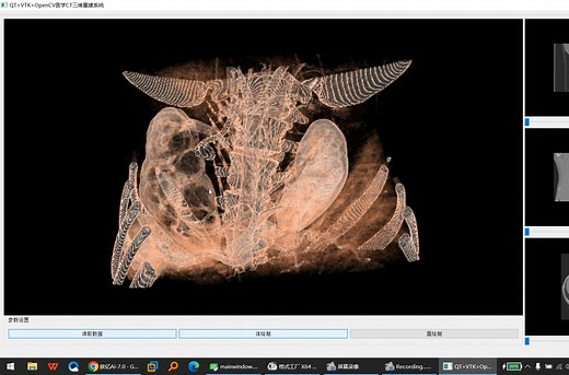 01_读取dcm医学图像三维重建，体绘制与面绘制