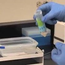 Video: Immunoblot Analysis