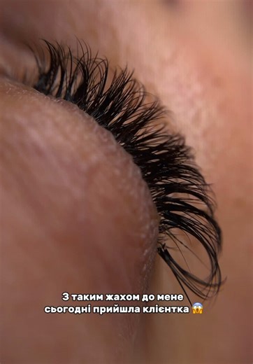 😢 З таким жахом до мене сьогодні прийшла клієнтка. Звичайно, таке нарощування не є нормою і може нашкодити. Через такі роботи з’являється міф, що штучні вії псують натуральні. Але це не так, якщо дотримуватися всіх правил безпеки. ✍🏻 Правильне нарощування включає: • повне очищення натуральних вій після зняття штучних • промивання та ретельне очищення міжресничного простору • підбір правильної товщини, враховуючи структуру натуральної вії • підбір правильної довжини, враховуючи довжину натураль