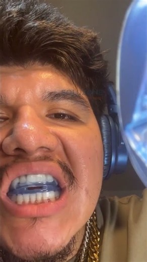 How anti snoring mouthpiece works
