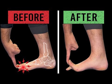 Fix Big Toe Pain With These Exercises