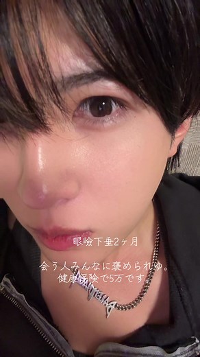 眼瞼下垂 2ヶ月後の成果と保険の詳細