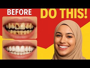 How to remove dental plaque and prevent cavities?