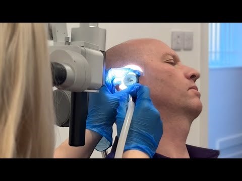 How Earwax Removal Works Step by Step