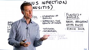 Sinus Infection Remedies Proven Natural Solutions | Dr. Berg