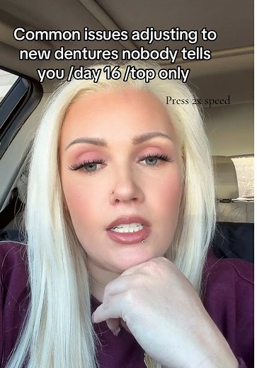 Common Issues When Adjusting to New Dentures