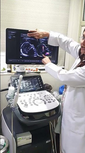 NT scan (Nuchal Translucency) is an ultrasound test usually done between 11 to 14 weeks of pregnancy