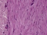 Three Muscle Types - Histology • Video • MEDtube.net
