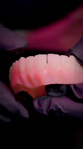 Full denture partial, printed on the Phrozen Dental 3D Printer Sonic CS ✨ #dental3dprinting #asmr #digitaldentistry | Evismart