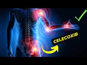 Celecoxib vs Other NSAIDs: Which Is Better for Arthritis Pain Relief?.