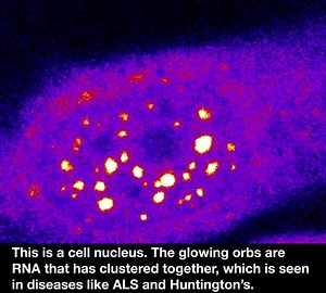 16K views · 542 reactions | In certain incurable neurological...