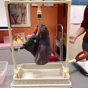 2K reactions · 4K shares | Smoker vs non smokers lungs... SMOKERS = MORONS! | Rush Brush | Facebook