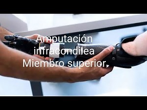 Amputación Infracondilea Miembro superior: fisioterapia