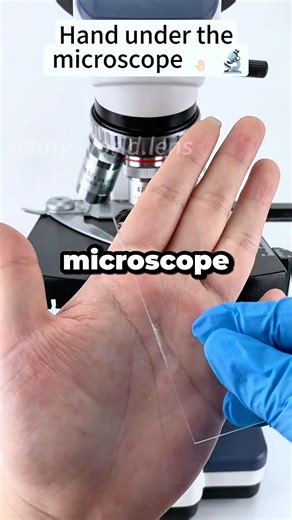 Hand under the microscope..