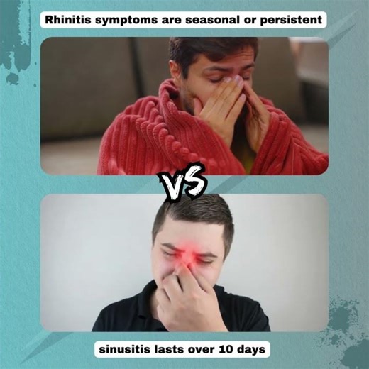 Allergic Rhinitis vs Sinusitis: Know the Difference