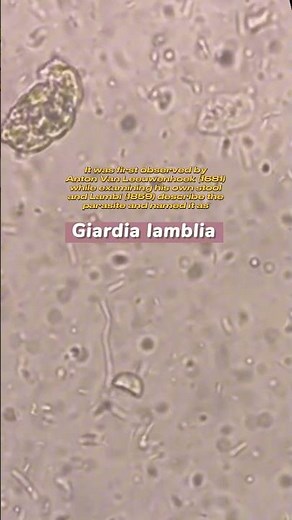 Giardia lamblia under the microscope #laboratory #microscope #mls #cls #medtechstudent