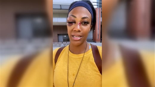 Olympic medalist describes attack by stranger in downtown LA