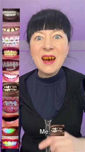 Yellow Teeth Challenge🦷😬sashachallange