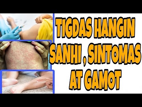 TIGDAS HANGIN: SANHI , SINTOMAS AT GAMOT AT PAANO ITO MAIIWASAN