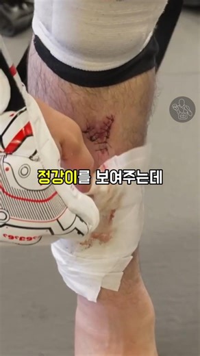 정강이가 작살나도 운동하는 메랍