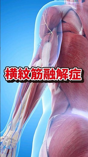 薬の副作用？横紋筋融解症とは #shorts #横紋筋融解症 #難病 #薬害