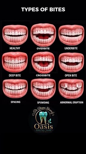 Types of Orthodontic Problems & Their Treatment|Braces|Invisalign|Oasis Dental Care Chennai
