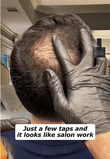 Achieve Flawless Hair with Easy-to-Use Hair Fibers