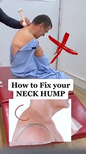 Here’s how to fix your neck hump with a simple neck hump stretch to do at home with a table or bed 🫶🏼🫶🏼 #neckhump #neckpain #LearnOnTikTok #GetAdjustedNow #NYCchiro how to fix a neck hump with an at home neck hump stretch relief | The Daily News