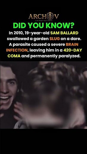 The Slug Dare That Changed His Life #history #facts