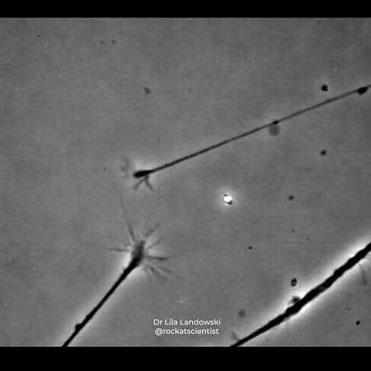 FINDING THAT CONNECTION © - Neurons connecting in a petri dish - growth cones sensing one another