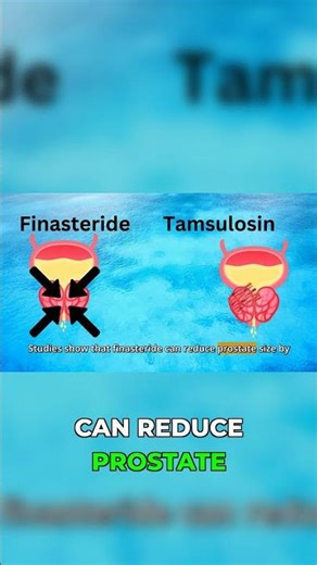 Finasteride Actually Works for Enlarged Prostate #BPH #results