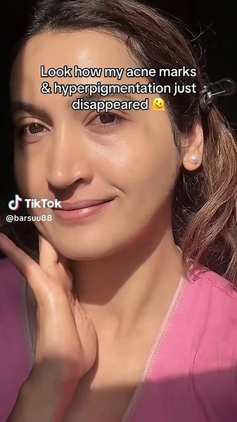 Transform Your Skin with Tinted SPF Solutions