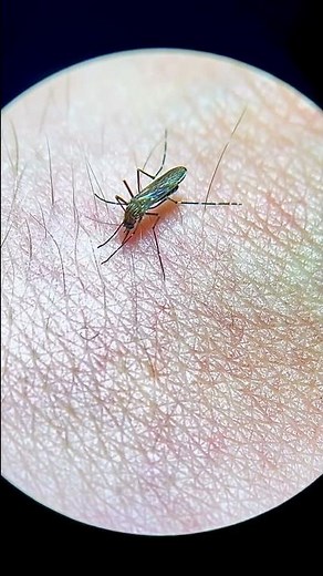 Mosquito bites my hand live under the microscope!