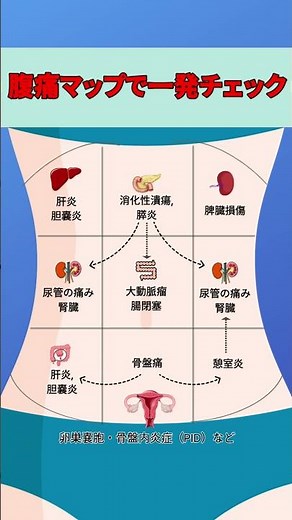 腹痛マップで一発チェック！どこが痛むかで原因が見えてくる #腹痛 #腹痛マップ #お腹の痛み #健康情報 #内科 #消化器 #婦人科#肝炎 #胆嚢炎 #膵炎 #脾臓損傷 #腎臓 #尿管結石