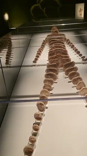 A Real Human Body Disected Into Fragments - Bodies Exhibit Luxor Las Vegas