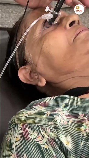 Immersion Biometry – Accurate Eye Measurement for Perfect Vision!