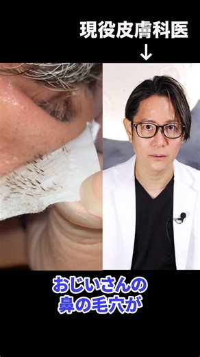 Are pore strips really a no-no? A practicing dermatologist explains #shorts