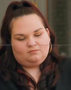 #pimplepopper #drpimplepoppers #cyst #cystremoval #pimplepopping #cyst #cystremoval #pimplepopping #skincareroutine #blackheadremoval #satisfyingvideos | pimple treatment