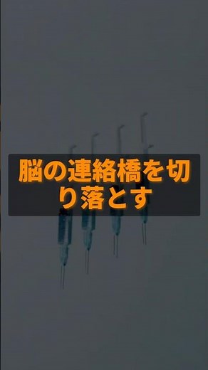 右脳と左脳を切り離す手術【脳梁離断術】