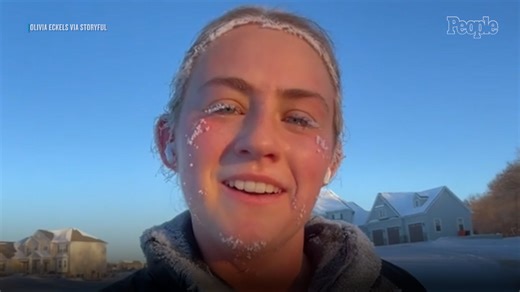 Ohio Runner Goes Viral After Documenting Frostbite During -8 Degree Jog