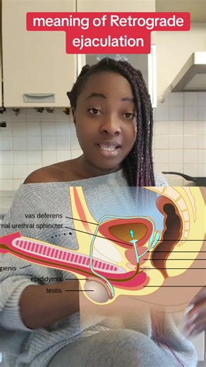 Understanding Retrograde Ejaculation: Causes and Effects