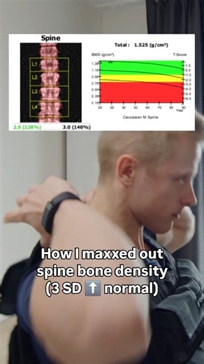 Siim Land on Instagram: "📈 Spine bone density: +3 standard deviations above average for 30-year-olds (30 = peak bone mass age; highest of all ages) After 12+ years of training, my DEXA showed lumbar spine BMD 3 standard deviations above the norm back when I was 30 years old Here’s what made the biggest difference 👇 Spinal overload for over a decade • Heavy barbell squats (biggest contributor — core + axial loading; requires to brace the core and keep the spine stable while overloading it) • A 
