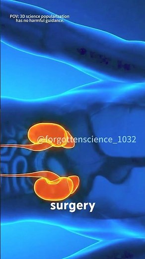 Shockwave Lithotripsy (3D Animation) | Kidney Stones Removal #kidneystones #kidney #hematuria
