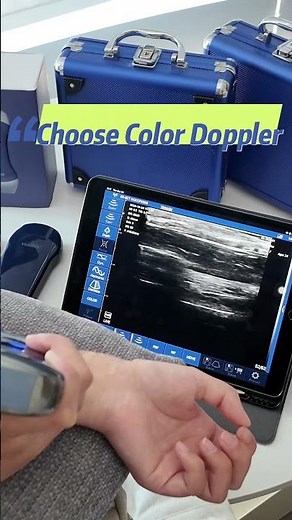 Precise Practice: Wireless Ultrasound for Radial Artery Imaging 👩‍⚕️🔍