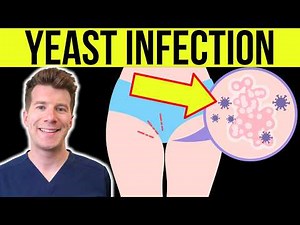 Doctor explains YEAST INFECTION (CANDIDA/THRUSH) in men and women | Causes, Symptoms, Treatment