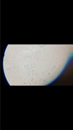 Unstained slide of cheek cells under microscope | Home made compound microscope
