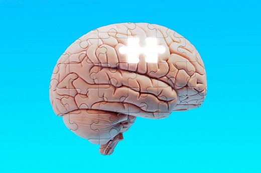 The Real-Life Amnesia Case That Inspired 50 First Dates