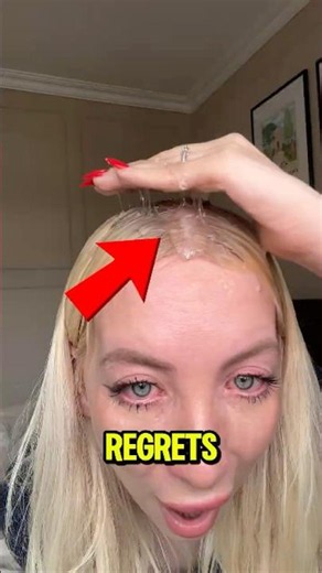 Her Scalp Was Sealed Shut by Mistake! 😱🚫