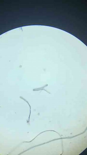 Exploring Nematodes Under the Microscope: Science Up Close!